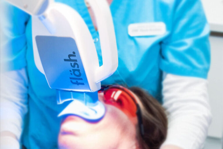 Fläsh Bleaching für weiße Zähne